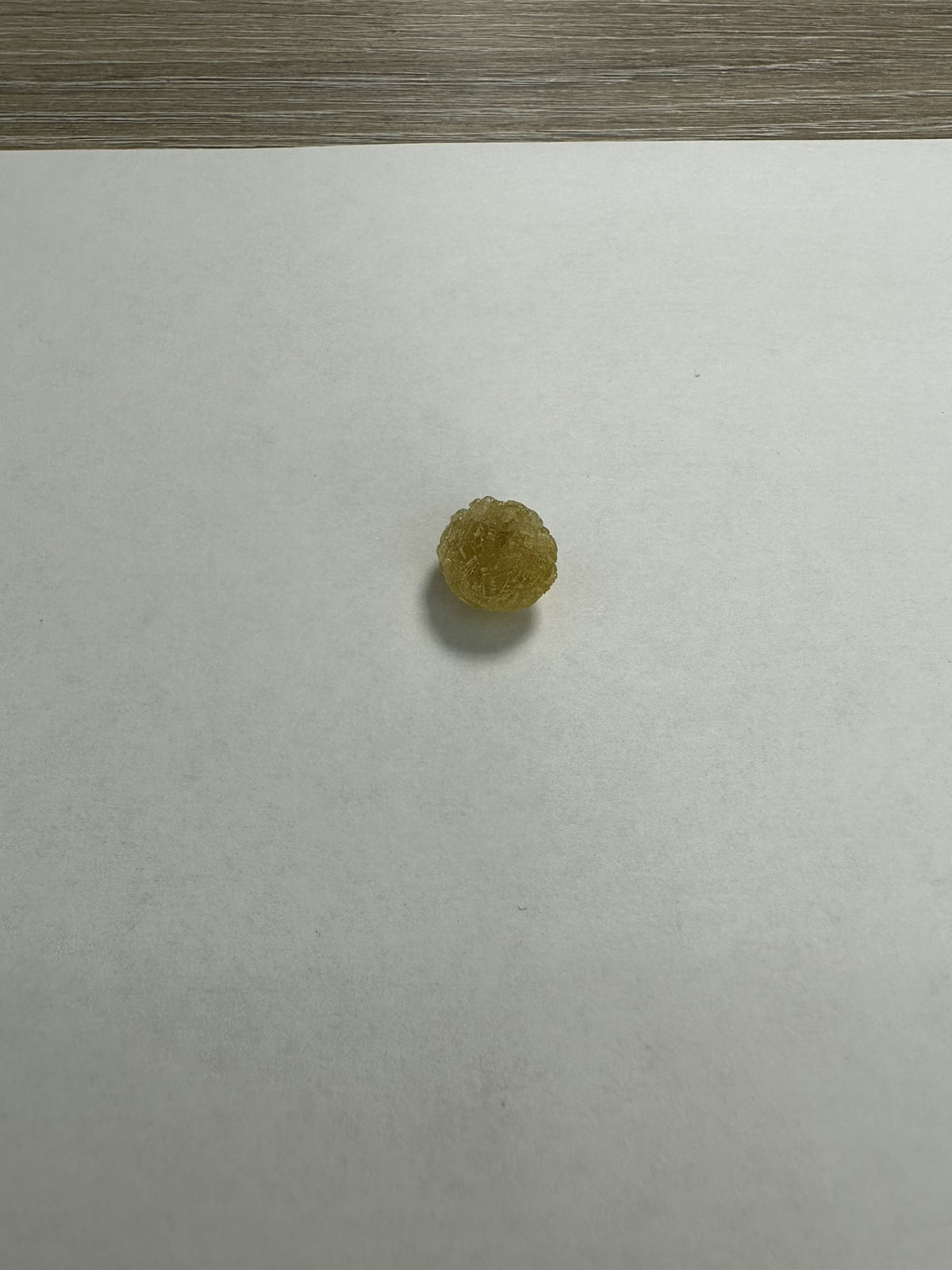 Камень в желчном